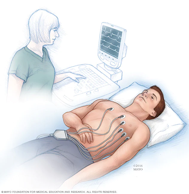 Electrocardiogram (ECG or EKG) Test